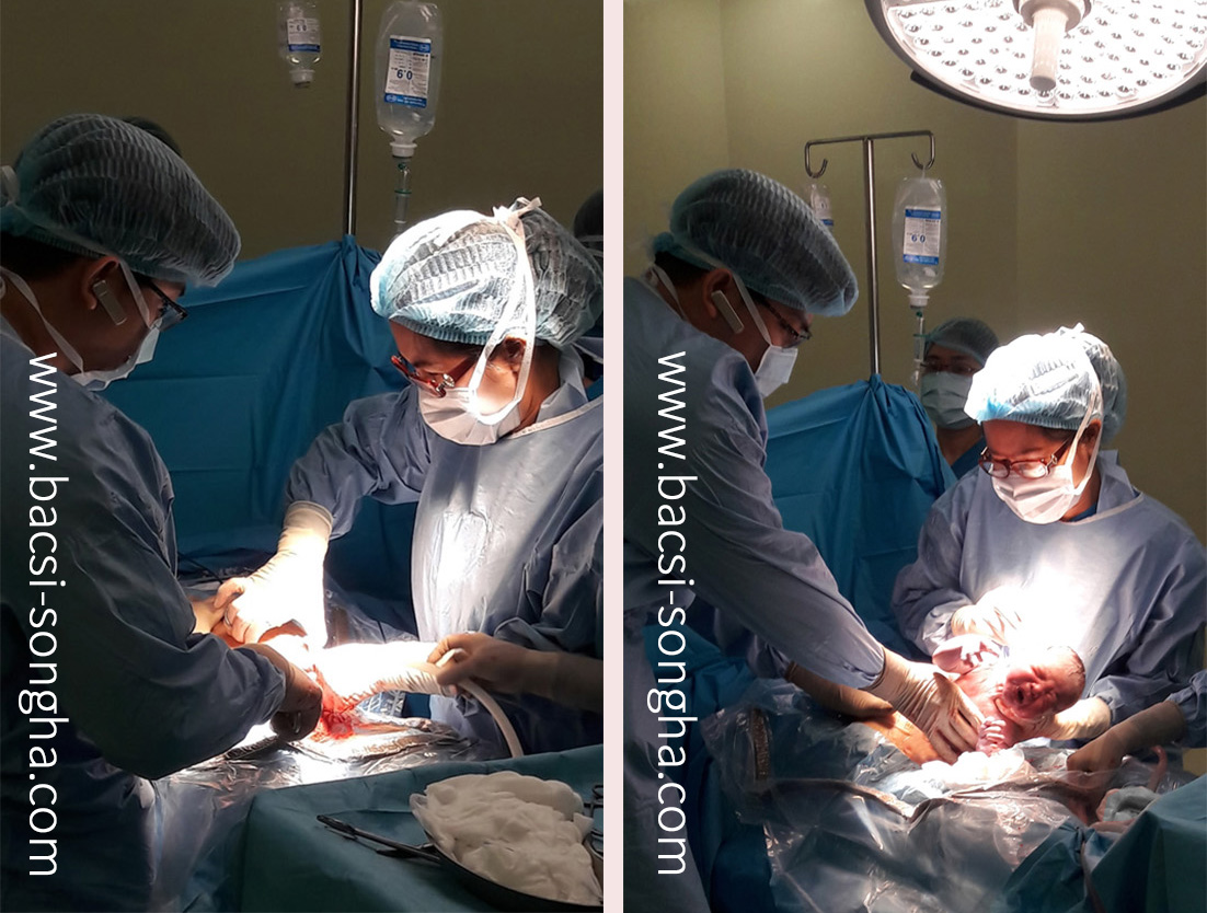 Phau thuat mo lay thai sau khi dung thuoc kich trung