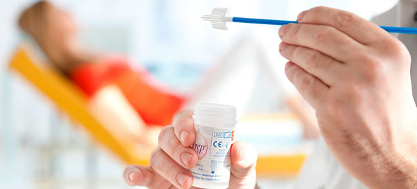 xet nghiem Thinprep