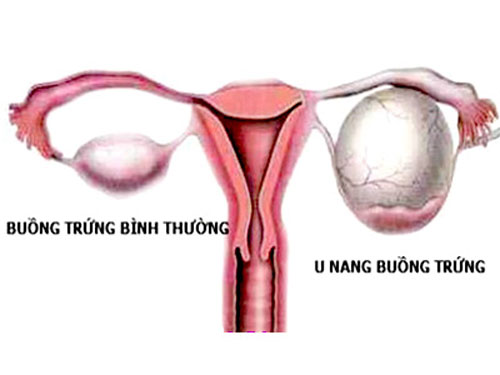 u nang buong trung